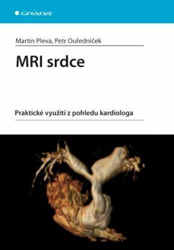 MRI srdce - Pleva Martin, Petr Ouředníček - e-kniha