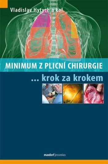 Minimum z plicní chirurgie krok za krokem - Hytych Roman