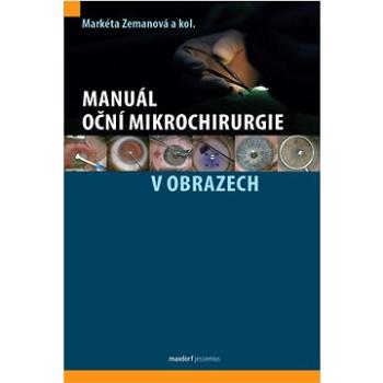 Manuál oční mikrochirurgie v obrazech (978-80-7345-748-8)