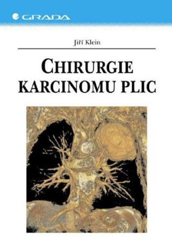 Chirurgie karcinomu plic - Jiří Klein - e-kniha