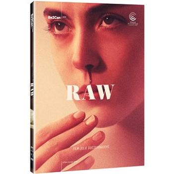 Raw - DVD (N03236)