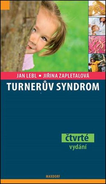Turnerův syndrom - Lebl Jan