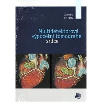 Multidetektorová výpočetní tomografie srdce (978-80-7262-880-3)