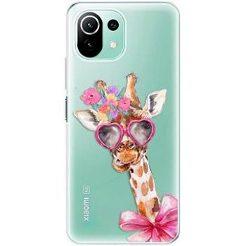 iSaprio Lady Giraffe pro Xiaomi Mi 11 Lite (ladgir-TPU3-Mi11L5G)