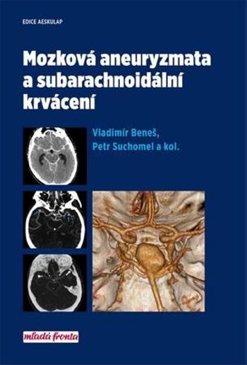 Mozková aneurysmata a subarachnoidální krvácení - Beneš Vladimír