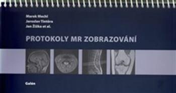 Protokoly MR Zobrazování - Marek Mechl, Jaroslav Tintěra, Jan Žižka