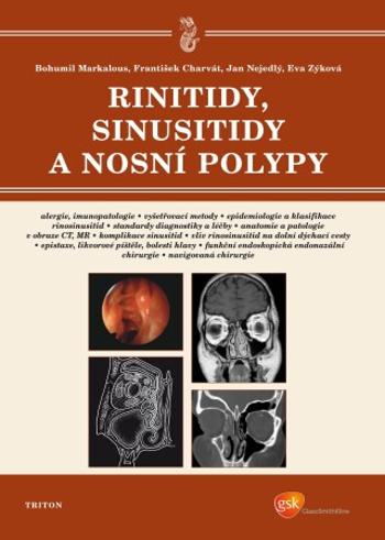 Rinitidy, sinusitidy a nosní polypy - Bohumil Markalous, Jan Nejedlý, František Charvát, Eva Zýková - e-kniha