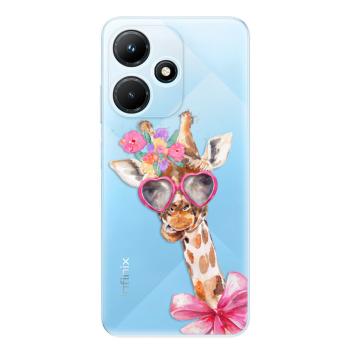 Odolné silikonové pouzdro iSaprio - Lady Giraffe - Infinix Hot 30i