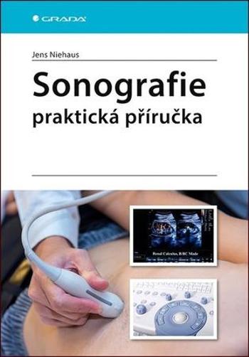 Sonografie Praktická příručka - Niehaus Jens