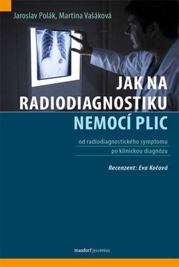 Jak na radiodiagnostiku nemocí plic - Vašáková Martina