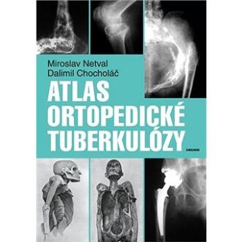 Atlas ortopedické tuberkulózy (9788024627182)