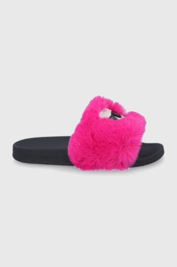 Pantofle Karl Lagerfeld růžová barva