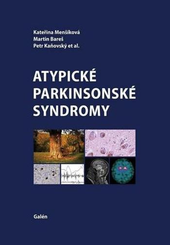 Atypické parkinsonské syndromy - Kaňovský Petr