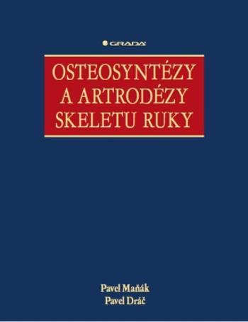 Osteosyntézy a artrodézy skeletu ruky - Maňák Pavel, Pavel Dráč - e-kniha