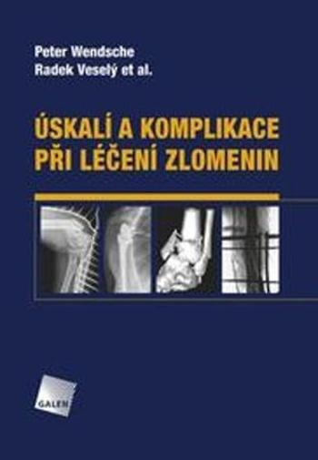 Úskalí a komplikace při léčení zlomenin - Radek Veselý - Wendsche Peter