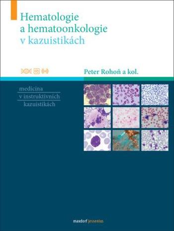 Hematologie a hematoonkologie v kazuistikách - Rohoň Peter