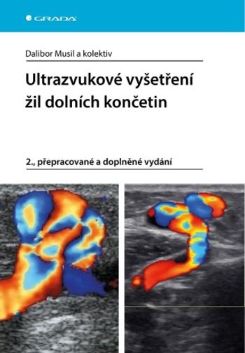 Ultrazvukové vyšetření žil dolních končetin - Dalibor Musil - e-kniha