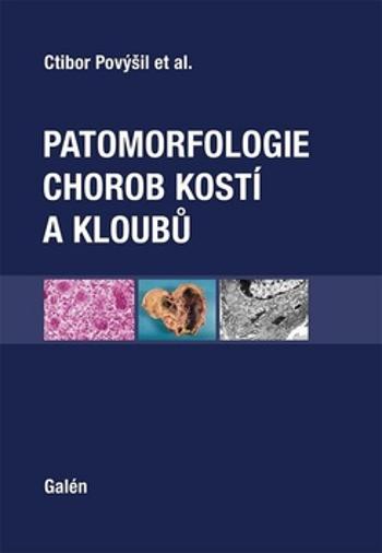 Patomorfologie chorob kostí a kloubů - Povýšil Ctibor