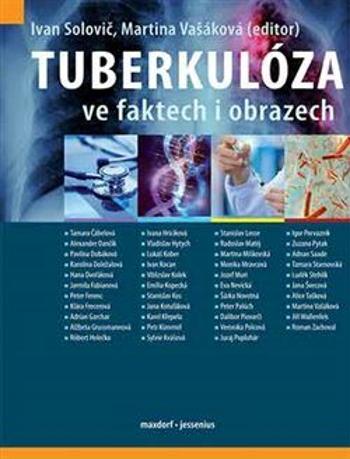 Tuberkulóza ve faktech i obrazech - Martina Vašáková, Solovič Ivan