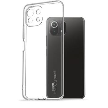 AlzaGuard Crystal Clear TPU Case pro Xiaomi Mi 11 Lite / 11 Lite 5G NE (AGD-PCT0043Z)