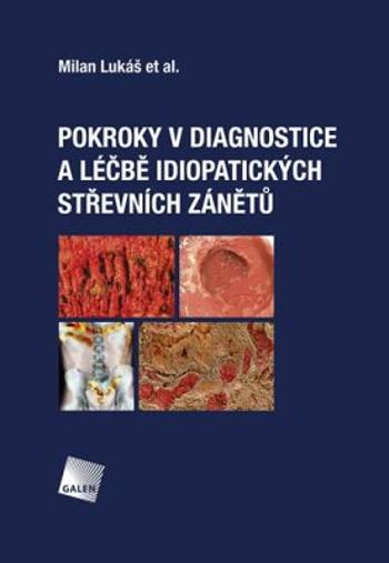 Pokroky v diagnostice a léčbě idiopatických střevních zánětů - Milan Lukáš