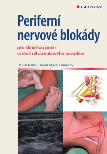 Periferní nervové blokády - Daniel Nalos, Dušan Mach - e-kniha
