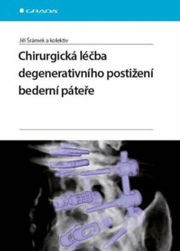 Chirurgická léčba degenerativního postižení bederní páteře - Jiří Šrámek