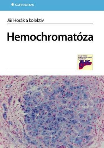 Hemochromatóza - Jiří Horák - e-kniha