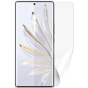 Screenshield HONOR 70 fólie na displej (HUA-HON70-D)