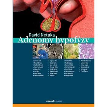 Adenomy hypofýzy (978-80-7345-620-7)