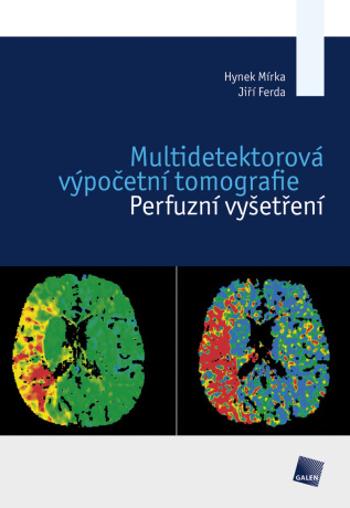 Multidetektorová výpočetní tomografie - Jiří Ferda, Hynek Mírka - e-kniha