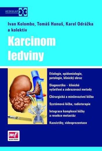 Karcinom ledviny + DVD - doc. MUDr. Karel Odrážka, Ph.D. - Hanuš Tomáš