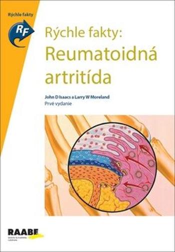 Rýchle fakty: Reumatoidná artritída - John D. Isaacs, Larry W. Moreland