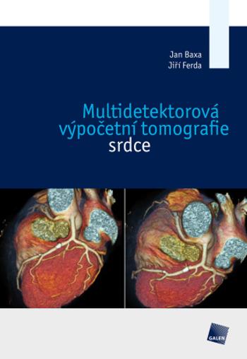 Multidetektorová výpočetní tomografie srdce - Jiří Ferda, Jan Baxa - e-kniha