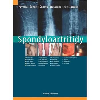 Spondyloartritidy (978-80-7345-679-5)