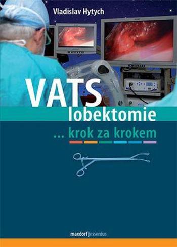 VATS lobektomie - Hytych Vladislav