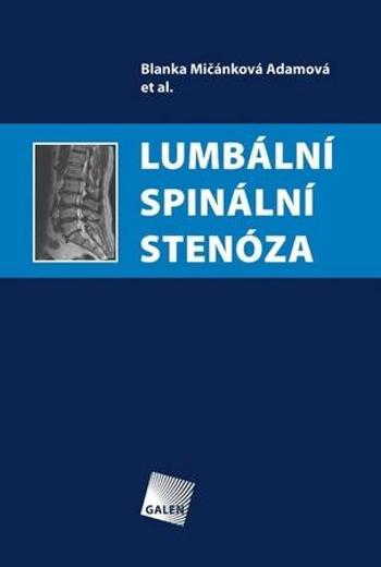 Lumbální spinální stenóza - Mičánková Adamová Blanka