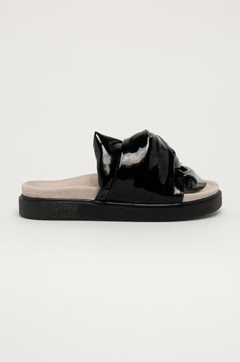 Kožené pantofle Inuikii dámské, černá barva