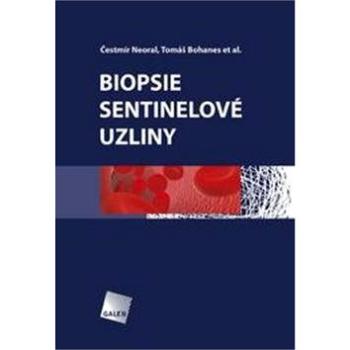 Biopsie sentinelové uzliny (978-80-7262-882-7)
