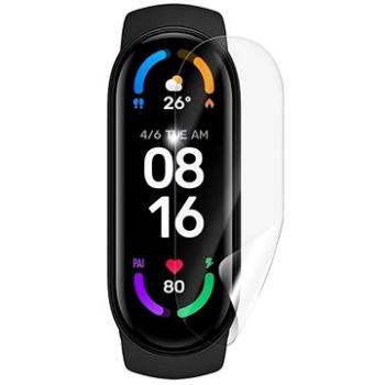 RedGlass Fólie Xiaomi Mi Band 6 6 ks 92632 (Sun-92632)