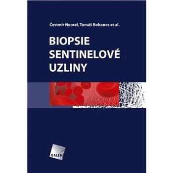 Biopsie sentinelové uzliny (978-80-726-2882-7)