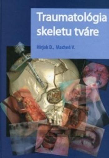 Traumatológia skeletu tváre - Machoň Vladimír