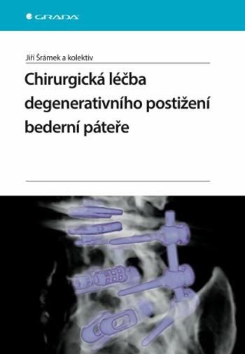 Chirurgická léčba degenerativního postižení bederní páteře - Jiří Šrámek - e-kniha