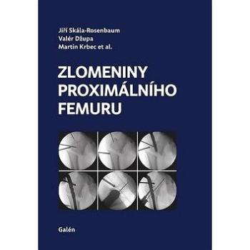 Zlomeniny proximálního femuru (978-80-7492-423-1)