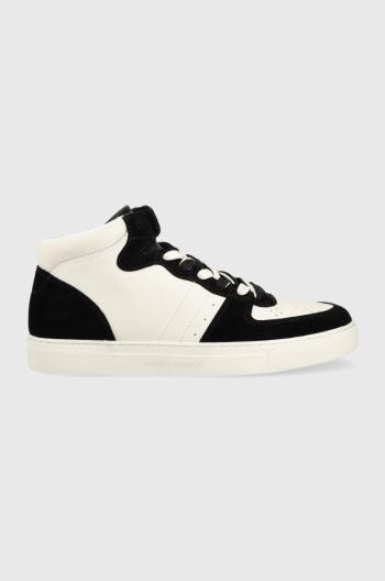 Sneakers boty Emporio Armani X4Z119 XN777 N814 černá barva, X4Z119 XN777 N814