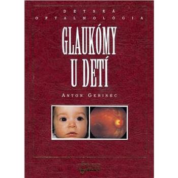 Glaukómy u detí: Detská oftalmológia (80-8063-103-4)