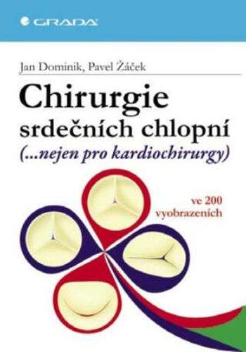 Chirurgie srdečních chlopní - Pavel Žáček, Jan Dominik - e-kniha