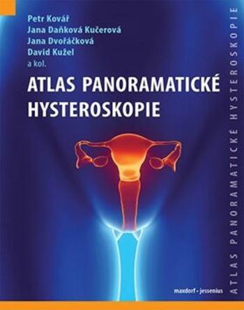 Atlas panoramatické hysteroskopie - Jana Dvořáčková, David Kužel, Petr Kovář, Daňková Kučerová Jana