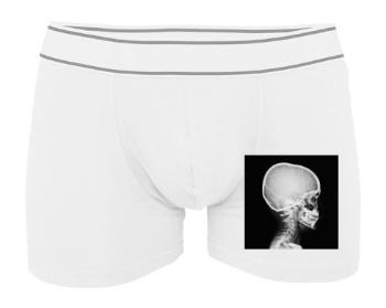 Pánské boxerky Contrast X-Ray