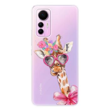 Odolné silikonové pouzdro iSaprio - Lady Giraffe - Xiaomi 12 Lite